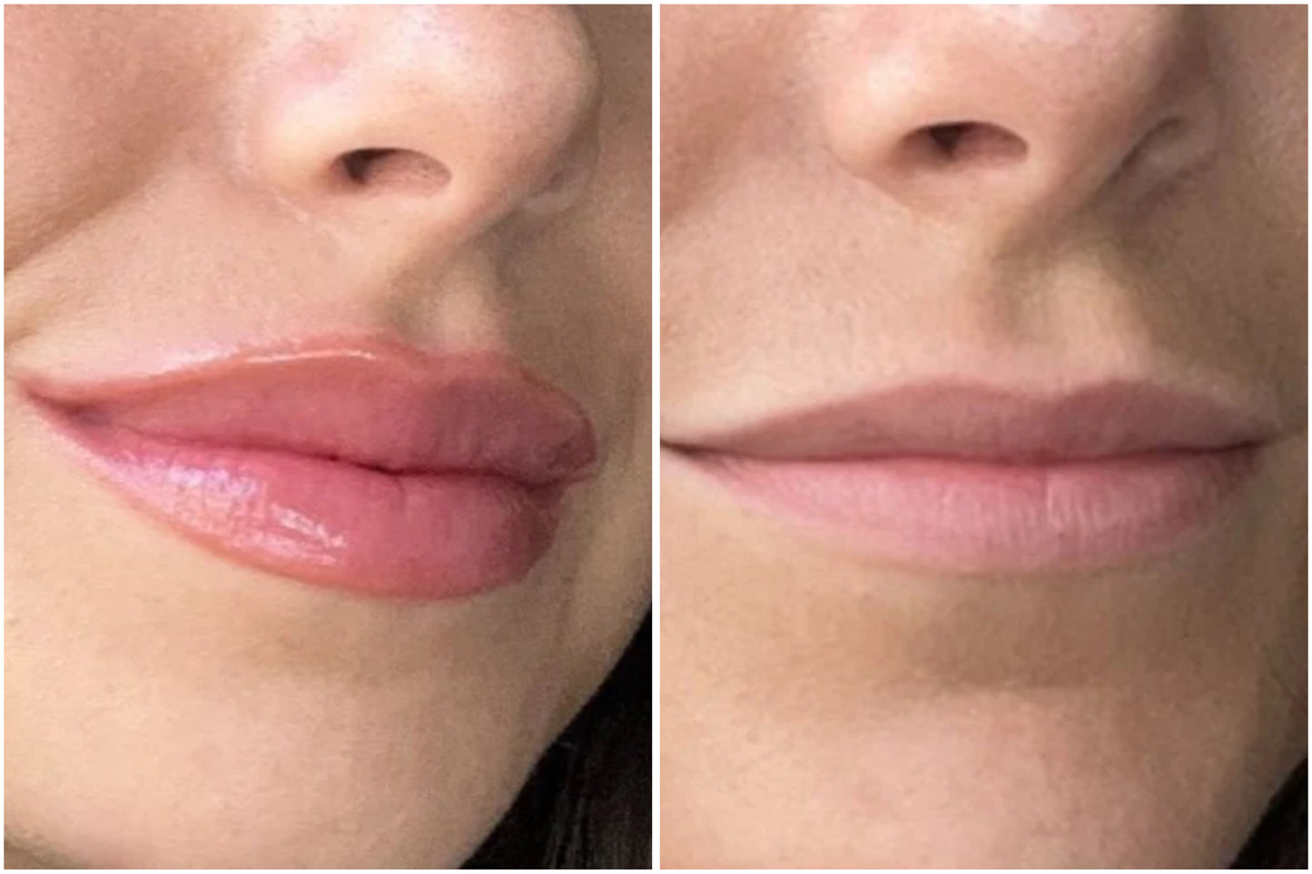 LipBoost Collagen
